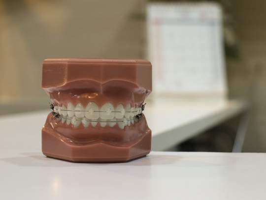 Implanty dentystyczne: Rozwiązanie dla utraconych zębów