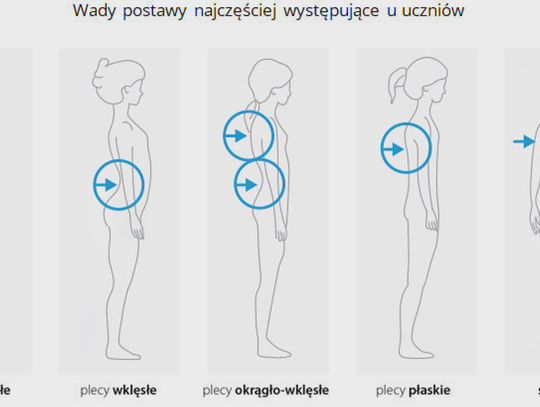 Kolejny program zdrowotny na Pomorzu Zachodnim na starcie. Eurofundusze na profilaktykę i korekcje wad podstawy wśród uczniów podstawówek 